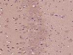 DENND1A Antibody in Immunohistochemistry (Paraffin) (IHC (P))