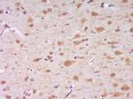 DENND4B Antibody in Immunohistochemistry (Paraffin) (IHC (P))