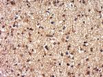 DEPDC1B Antibody in Immunohistochemistry (Paraffin) (IHC (P))