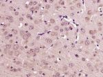 DEXI Antibody in Immunohistochemistry (Paraffin) (IHC (P))