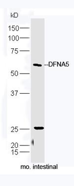 DFNA5 Antibody in Western Blot (WB)