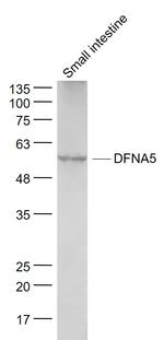 DFNA5 Antibody in Western Blot (WB)