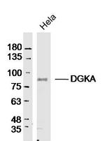 DGKA Antibody in Western Blot (WB)