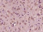 DGKB Antibody in Immunohistochemistry (Paraffin) (IHC (P))