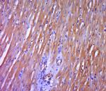 DGKH Antibody in Immunohistochemistry (Paraffin) (IHC (P))