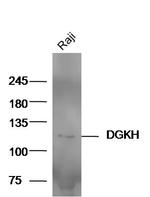 DGKH Antibody in Western Blot (WB)