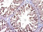 DGKK Antibody in Immunohistochemistry (Paraffin) (IHC (P))