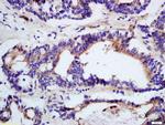 DHDH Antibody in Immunohistochemistry (Paraffin) (IHC (P))