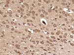 DHX30 Antibody in Immunohistochemistry (Paraffin) (IHC (P))