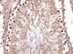 DHX36 Antibody in Immunohistochemistry (Paraffin) (IHC (P))