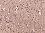 DHX36 Antibody in Immunohistochemistry (Paraffin) (IHC (P))