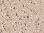 DHX36 Antibody in Immunohistochemistry (Paraffin) (IHC (P))