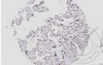 MEK1 Antibody in Immunohistochemistry (Paraffin) (IHC (P))