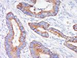 MEK1 Antibody in Immunohistochemistry (Paraffin) (IHC (P))
