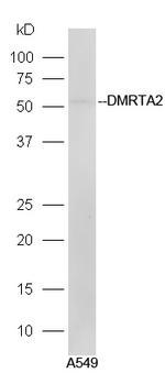 DMRTA2 Antibody in Western Blot (WB)