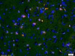 IGFBP3 Antibody in Immunohistochemistry (Paraffin) (IHC (P))