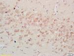 IGFBP3 Antibody in Immunohistochemistry (Paraffin) (IHC (P))