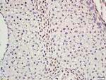 DNA polymerase epsilon subunit 2 Antibody in Immunohistochemistry (Paraffin) (IHC (P))