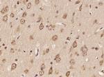 DNAH6 Antibody in Immunohistochemistry (Paraffin) (IHC (P))