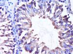 DNAJC5G Antibody in Immunohistochemistry (Paraffin) (IHC (P))