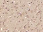 DOLPP1 Antibody in Immunohistochemistry (Paraffin) (IHC (P))