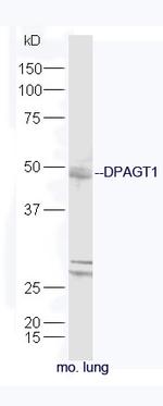 DPAGT1 Antibody in Western Blot (WB)