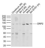 DRP2 Antibody in Western Blot (WB)