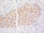 DSCR3 Antibody in Immunohistochemistry (Paraffin) (IHC (P))