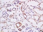 DTX3L Antibody in Immunohistochemistry (Paraffin) (IHC (P))