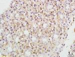 VCP Antibody in Immunohistochemistry (Paraffin) (IHC (P))