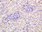TLR3 Antibody in Immunohistochemistry (Paraffin) (IHC (P))