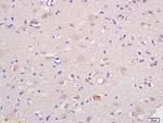 HSP75/TRAP1 Antibody in Immunohistochemistry (Paraffin) (IHC (P))