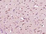 DYRK4 Antibody in Immunohistochemistry (Paraffin) (IHC (P))