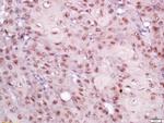 EIF3S4 Antibody in Immunohistochemistry (Paraffin) (IHC (P))