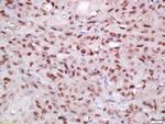 EIF3S4 Antibody in Immunohistochemistry (Paraffin) (IHC (P))