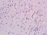 ErbB-3/HER3 Antibody in Immunohistochemistry (Paraffin) (IHC (P))