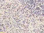 ErbB-3/HER3 Antibody in Immunohistochemistry (Paraffin) (IHC (P))