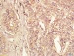 eIF4ENIF1 Antibody in Immunohistochemistry (Paraffin) (IHC (P))