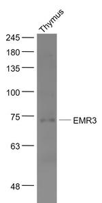 EMR3 Antibody in Western Blot (WB)