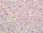 IL-6R Beta/CD130/gp130 Antibody in Immunohistochemistry (Paraffin) (IHC (P))