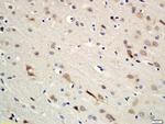 Erbin Antibody in Immunohistochemistry (Paraffin) (IHC (P))