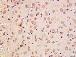 Erbin Antibody in Immunohistochemistry (Paraffin) (IHC (P))