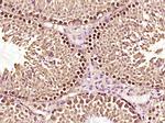 ERRFI1 Antibody in Immunohistochemistry (Paraffin) (IHC (P))