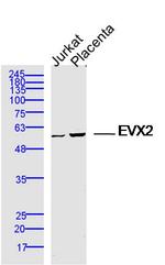 EVX2 Antibody in Western Blot (WB)