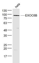 EXOC6B Antibody in Western Blot (WB)