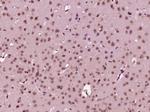 EXOSC4 Antibody in Immunohistochemistry (Paraffin) (IHC (P))