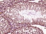 EXOSC5 Antibody in Immunohistochemistry (Paraffin) (IHC (P))
