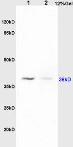 PAFR Antibody in Immunohistochemistry (Paraffin) (IHC (P))