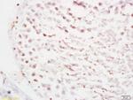 RBBP6/P2P-R Antibody in Immunohistochemistry (Paraffin) (IHC (P))