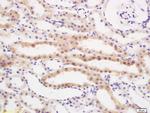 RBBP6/P2P-R Antibody in Immunohistochemistry (Paraffin) (IHC (P))